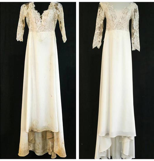 Before After Gown Cleaning